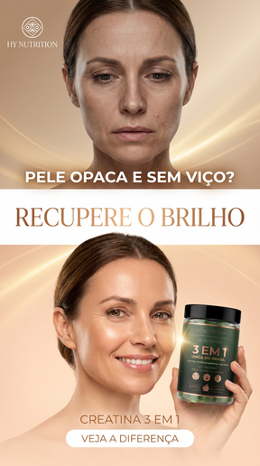 Beauty Creatine – Creatina em Gummies com Colágeno e Ácido Hialurônico para Mulheres 35+ Hy Nutrition